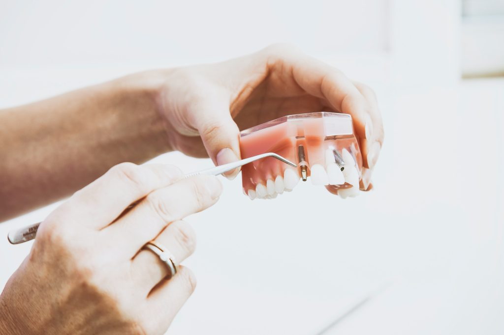 holding dental implants sample
